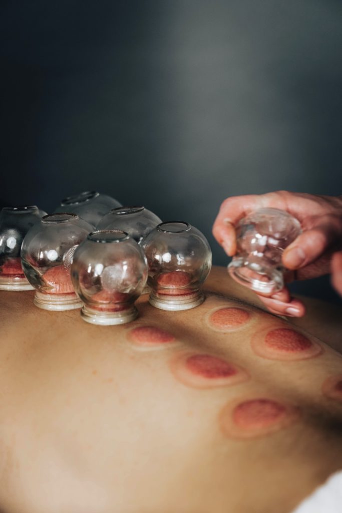 μασάζ με βεντούζες στο σπίτι Αθήνα αφαίρεση